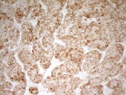 MRRF Monoclonal Antibody (OTI1D5), TrueMAB , OriGene 100 &mu;L; Unconjugated:Antibodies,