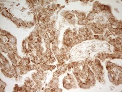 MRRF Monoclonal Antibody (OTI2A9), TrueMAB , OriGene 100 &mu;L; Unconjugated:Antibodies,