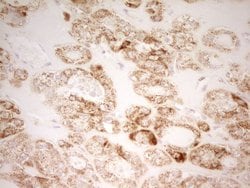MRRF Monoclonal Antibody (OTI2A9), TrueMAB , OriGene 100 &mu;L; Unconjugated:Antibodies,