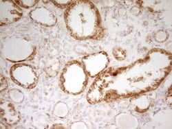 MRRF Monoclonal Antibody (OTI2A9), TrueMAB , OriGene 100 &mu;L; Unconjugated:Antibodies,