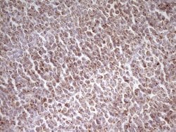 MRRF Monoclonal Antibody (OTI2A8), TrueMAB , OriGene 100 &mu;L; Unconjugated:Antibodies,
