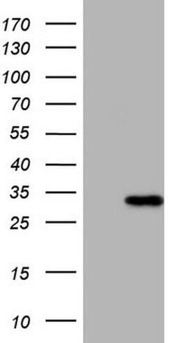 MRRF Monoclonal Antibody (OTI7F1), TrueMAB , OriGene:Antibodies:Primary