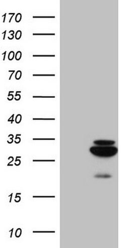 MRRF Monoclonal Antibody (OTI2A8), TrueMAB , OriGene:Antibodies:Primary