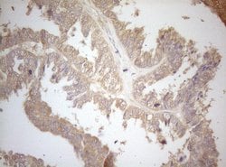 MS4A12 Mouse anti-Human, Clone: OTI5F5, lyophilized, TrueMAB 100 &mu;g;