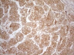 MS4A12 Mouse anti-Human, Clone: OTI5F5, lyophilized, TrueMAB 100 &mu;g;