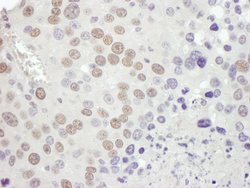 MSH2 Rabbit anti-Human, Mouse, Polyclonal, Bethyl Laboratories 100 &mu;L;