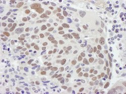 MSH2 Rabbit anti-Human, Mouse, Polyclonal, Bethyl Laboratories 100 &mu;L;