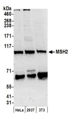 MSH2 Polyclonal Antibody, Bethyl Laboratories 20 &mu;L; Unconjugated:Antibodies,