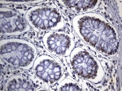 MSH2 Mouse anti-Human, Clone: UMAB259, liquid, UltraMAB 100 &mu;L; Unconjugated:Antibodies,