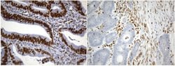 MSH2 Mouse anti-Human, Clone: UMAB259, liquid, UltraMAB 100 &mu;L; Unconjugated:Antibodies,