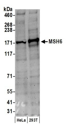 MSH6 Goat anti-Human, Polyclonal, Bethyl Laboratories 100 &mu;L; Unconjugated:Antibodies,