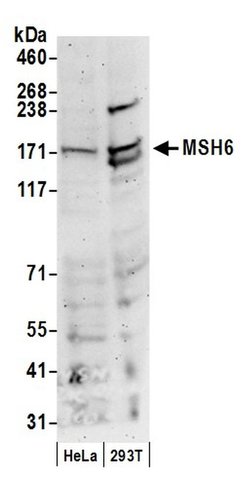 MSH6 Polyclonal Antibody, Bethyl Laboratories 20 &mu;l; Unlabeled:Antibodies,