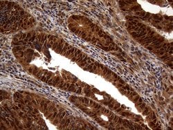 MSH6 Monoclonal Antibody (OTI5D1), TrueMAB , OriGene 100 &mu;L; Unconjugated:Antibodies,