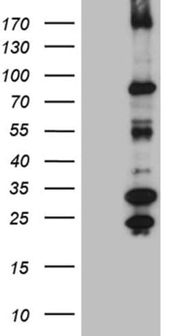 MSH6 Monoclonal Antibody (OTI5D1), TrueMAB , OriGene 100 &mu;L; Unconjugated:Antibodies,