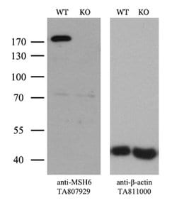 MSH6 Monoclonal Antibody (OTI5D1), TrueMAB , OriGene 100 &mu;L; Unconjugated:Antibodies,