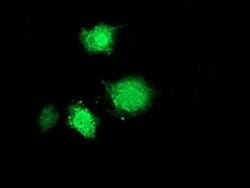 MSI1 Monoclonal Antibody (OTI1G8), TrueMAB , OriGene 100 &mu;L; Unconjugated:Antibodies,