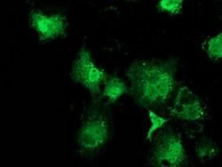 MSI1 Monoclonal Antibody (OTI2A10), TrueMAB , OriGene 100 &mu;L; Unconjugated:Antibodies,