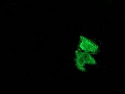 MSI1 Monoclonal Antibody (OTI2H9), TrueMAB , OriGene:Antibodies:Primary