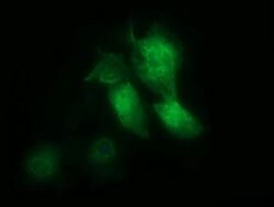 MSI1 Monoclonal Antibody (OTI2B2), TrueMAB , OriGene:Antibodies:Primary