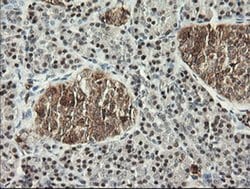 MSI1 Monoclonal Antibody (OTI1G8), TrueMAB , OriGene 100 &mu;L; Unconjugated:Antibodies,