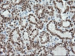 MSI1 Monoclonal Antibody (OTI1G8), TrueMAB , OriGene 100 &mu;L; Unconjugated:Antibodies,
