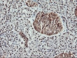 MSI1 Mouse anti-Human, Clone: OTI2H9, lyophilized, TrueMAB 100 &mu;g; Unconjugated:Antibodies,