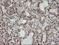 MSI1 Monoclonal Antibody (OTI2H9), TrueMAB , OriGene 100 &mu;L; Unconjugated:Antibodies,