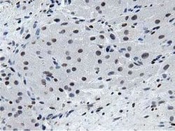 MSI1 Monoclonal Antibody (OTI3G4), TrueMAB , OriGene 30 &mu;L; Unconjugated:Antibodies,