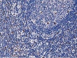 MSI1 Mouse anti-Human, Clone: OTI3G4, lyophilized, TrueMAB 100 &mu;g; Unconjugated:Antibodies,