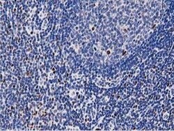 MSI1 Monoclonal Antibody (OTI3G4), TrueMAB , OriGene 30 &mu;L; Unconjugated:Antibodies,