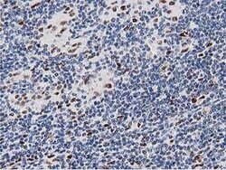 MSI1 Mouse anti-Human, Clone: OTI3G4, lyophilized, TrueMAB 100 &mu;g; Unconjugated:Antibodies,