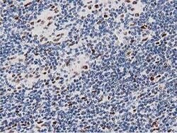 MSI1 Monoclonal Antibody (OTI3G4), TrueMAB , OriGene 30 &mu;L; Unconjugated:Antibodies,