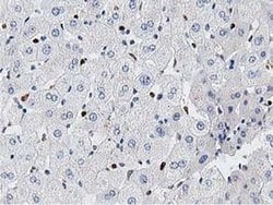 MSI1 Monoclonal Antibody (OTI3G4), TrueMAB , OriGene:Antibodies:Primary