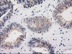 MSI1 Monoclonal Antibody (OTI3F4), TrueMAB , OriGene 30 &mu;L; Unconjugated:Antibodies,