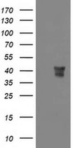 MSI1 Monoclonal Antibody (OTI1G8), TrueMAB , OriGene 100 &mu;L; Unconjugated:Antibodies,