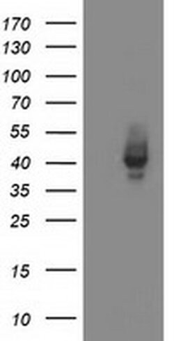 MSI1 Monoclonal Antibody (OTI2A10), TrueMAB , OriGene 100 &mu;L; Unconjugated:Antibodies,