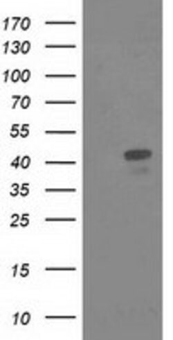 MSI1 Mouse anti-Human, Clone: OTI2H9, lyophilized, TrueMAB 100 &mu;g; Unconjugated:Antibodies,