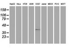 MSI1 Mouse anti-Human, Clone: OTI2H9, lyophilized, TrueMAB 100 &mu;g; Unconjugated:Antibodies,