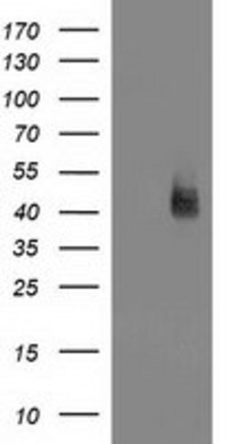 MSI1 Mouse anti-Human, Clone: OTI2E9, lyophilized, TrueMAB 100 &mu;g; Unconjugated:Antibodies,