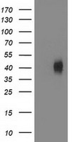 MSI1 Monoclonal Antibody (OTI3G4), TrueMAB , OriGene:Antibodies:Primary