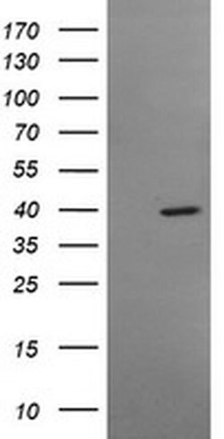 MSI1 Monoclonal Antibody (OTI2B2), TrueMAB , OriGene:Antibodies:Primary