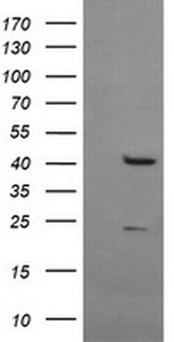 MSI1 Monoclonal Antibody (OTI3C2), TrueMAB , OriGene 100 &mu;L | Buy Online | Origene Technologies | Fisher Scientific