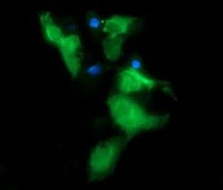 MSI2 Monoclonal Antibody (OTI2F10), TrueMAB , OriGene 100 &mu;L | Buy Online | Origene Technologies | Fisher Scientific