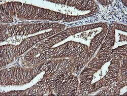 MSI2 Monoclonal Antibody (OTI2F10), TrueMAB , OriGene 100 &mu;L | Buy Online | Origene Technologies | Fisher Scientific