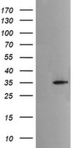 MSI2 Monoclonal Antibody (OTI2F10), TrueMAB , OriGene 100 &mu;L | Buy Online | Origene Technologies | Fisher Scientific