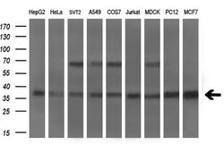 MSI2 Monoclonal Antibody (OTI2F10), TrueMAB , OriGene 100 &mu;L | Buy Online | Origene Technologies | Fisher Scientific