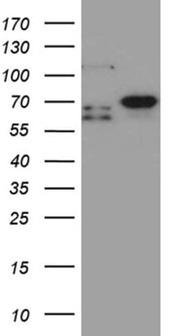 MSL2 Monoclonal Antibody (OTI3B11), TrueMAB , OriGene 100 &mu;L; Unconjugated:Antibodies,