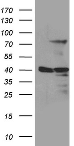 MSL2 Monoclonal Antibody (OTI3G5), TrueMAB , OriGene 100 &mu;L; Unconjugated:Antibodies,
