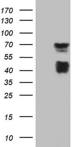 MSLN Monoclonal Antibody (OTI1B7), TrueMAB , OriGene:Antibodies:Primary