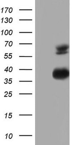 MSLN Mouse anti-Human, Clone: OTI1G8, lyophilized, TrueMAB 100 &mu;g; Unconjugated:Antibodies,